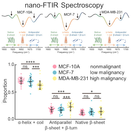 nano Vesicle Tumor Diagnostic IR neaSCOPE+s