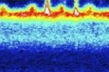 Mapping local conductivity in semiconductor devices IR neaSCOPE+s