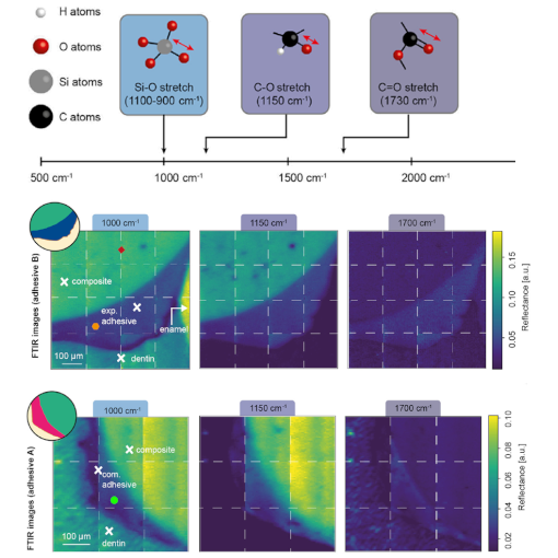 Advances in Dental Materials IR neaSCOPE+s
